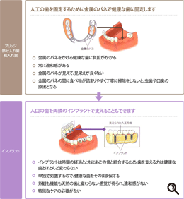 奥歯を含めて複数の歯を失った場合